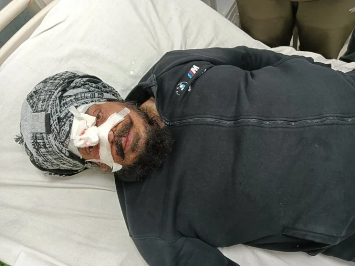 फिरौती न देने पर  हमलावरों ने हथियारों से किया हमला, सोने का सामान लूटकर फरार
